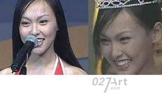 龅牙娱乐吃瓜,揭秘娱乐圈吃瓜背后的真相与笑料